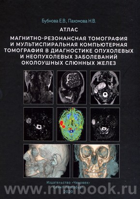 Магнитно-резонансная томография и мультиспиральная компьютерная томография в диагностике опухолевых и неопухолевых заболеваний околоушных слюнных желез