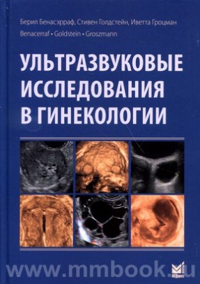 Ультразвуковые исследования в гинекологии - Бенасэрраф Б.