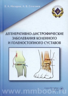 Дегенеративно-дистрофические заболевания коленного и голеностопного суставов