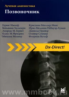 Лучевая диагностика. Позвоночник