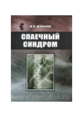 Спаечный синдром