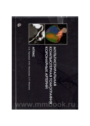 Мультиспиральная компьютерная томография коронарных артерий. Атлас