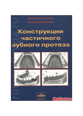 Конструкции частичных зубных протезов