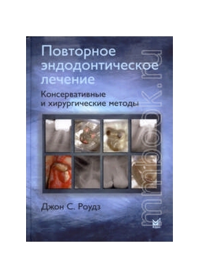 Повторное эндодонтическое лечение