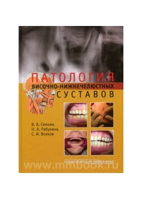 Патология височно-нижнечелюстных суставов