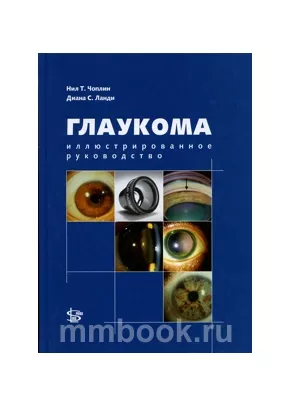 Глаукома. Иллюстрированное руководство