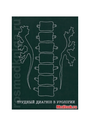 Трудный диагноз в урологии