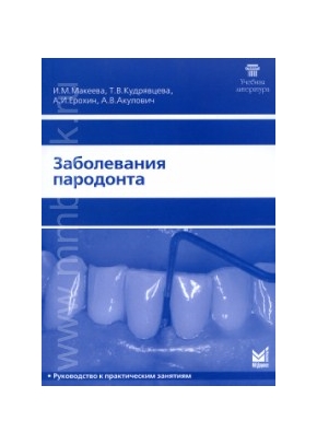 Заболевания пародонта