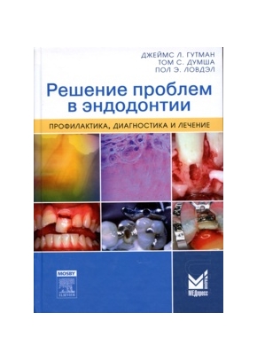 Решение проблем в эндодонтии