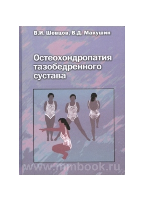 Остеохондропатия тазобедренного сустава