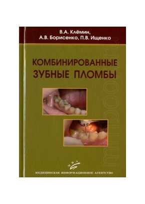 Комбинированные зубные пломбы