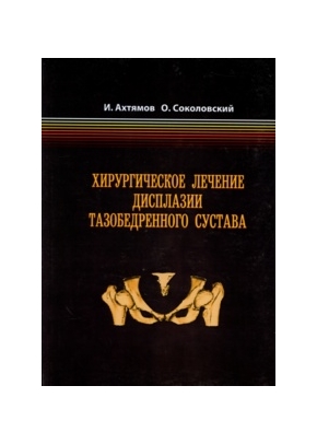 Хирургическое лечение дисплазии тазобедренного сустава