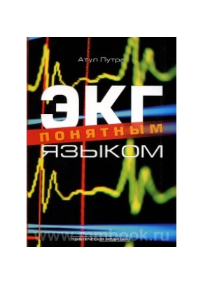ЭКГ понятным языком