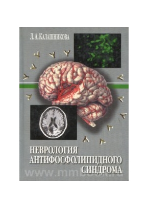 Неврология антифосфолипидного синдрома