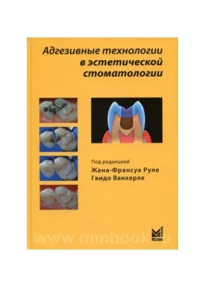 Адгезивные технологии в эстетической стоматологии