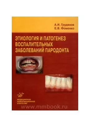 Этиология и патогенез воспалительных заболеваний пародонта