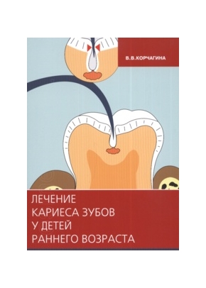 Лечение кариеса зубов у детей раннего возраста