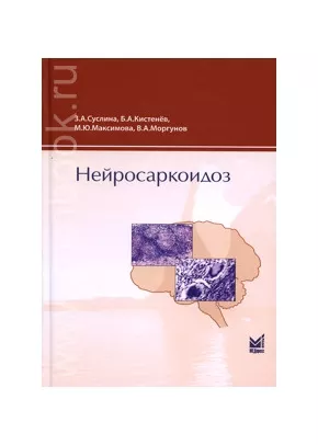 Нейросаркоидоз