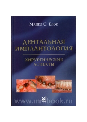 Дентальная имплантология: хирургические аспекты