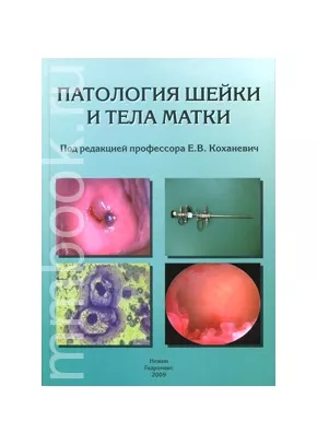 Патология шейки и тела матки