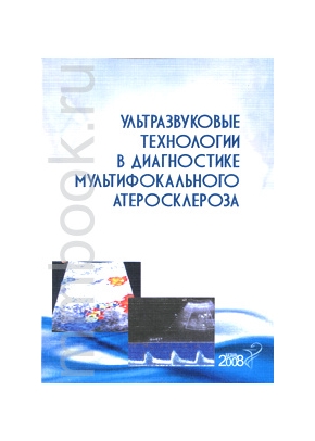 Ультразвуковые технологии в диагностике мультифокального атеросклероза