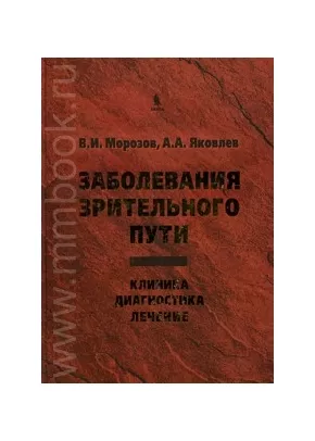 Заболевания зрительного пути: Клиника. Диагностика. Лечение
