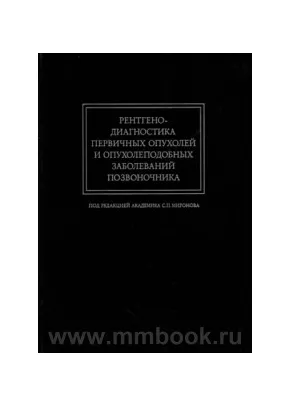Рентгенодиагностика первичных опухолей и опухолеподобных заболеваний позвоночника