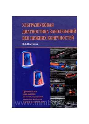 Ультразвуковая диагностика заболеваний вен нижних конечностей