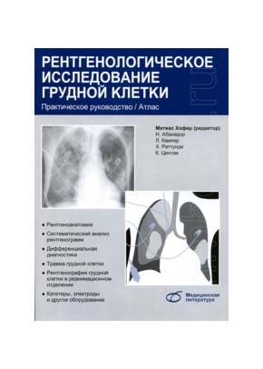 Рентгенологическое исследование грудной клетки