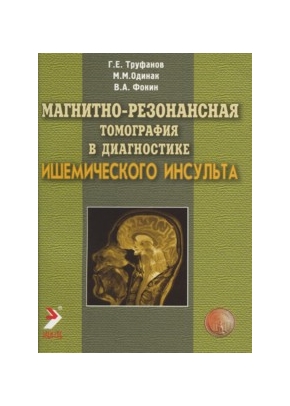 Магнитно-резонансная томография в диагностике ишемического инсульта