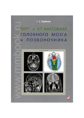 МРТ-и КТ-анатомия головного мозга и позвоночника