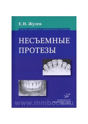 Несъемные протезы: теория