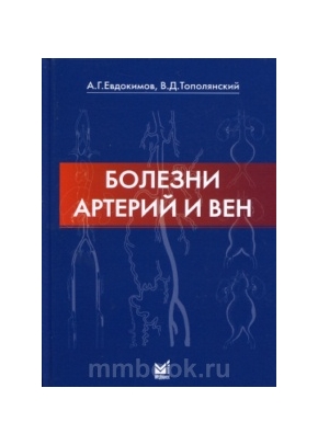 Болезни артерий и вен
