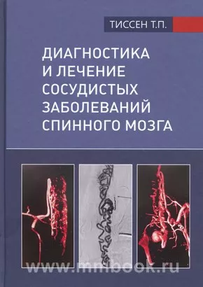 Диагностика и лечение сосудистых заболеваний спинного мозга
