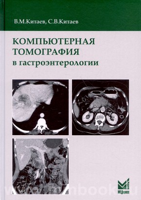 Компьютерная томография в гастроэнтерологии: руководство для врачей