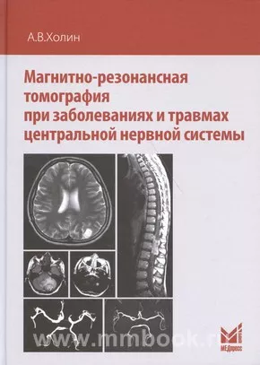 Магнитно-резонансная томография при заболеваниях и травмах центральной нервной системы 