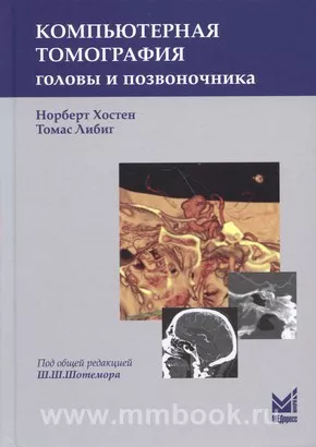 Компьютерная томография головы и позвоночника
