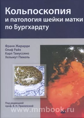 Кольпоскопия и патология шейки матки по Бургхардту