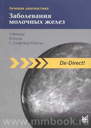 Лучевая диагностика. Заболевания молочных желез