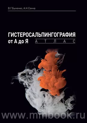 Гистеросальпингография от А до Я: атлас
