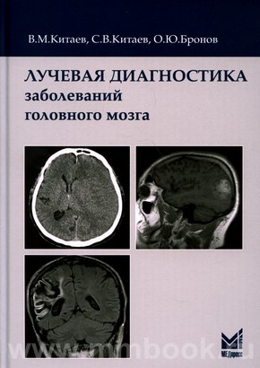 Лучевая диагностика заболеваний головного мозга