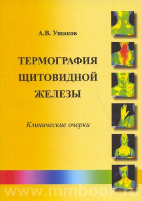 Ушаков А.В. - Термография щитовидной железы. Клинические очерки