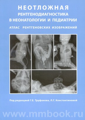 Неотложная рентгенодиагностика в неонатологии и педиатрии (Атлас рентгеновских изображений). Руководство для врачей