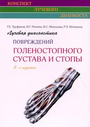 Лучевая диагностика повреждений голеностопного сустава и стопы