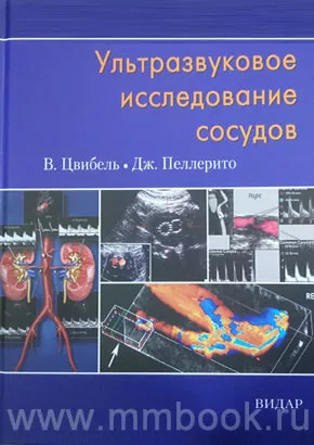 Ультразвуковое исследование сосудов