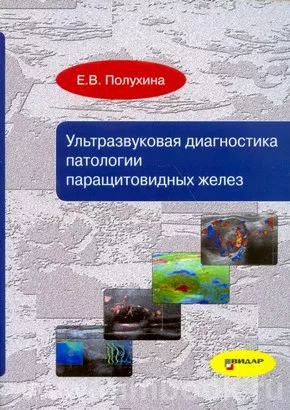 Ультразвуковая диагностика патологии паращитовидных желез