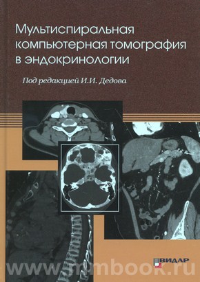 Мультиспиральная компьютерная томография в эндокринологии