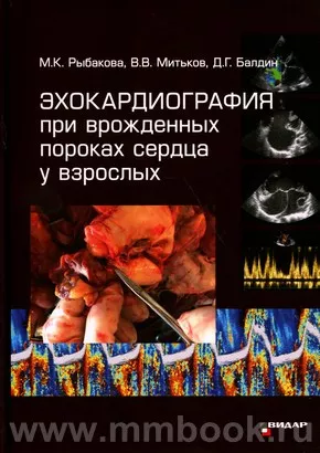 Эхокардиография при врожденных пороках сердца у взрослых