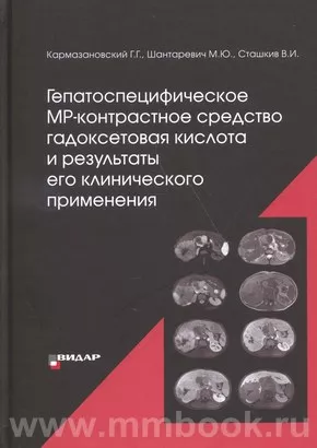 Гепатоспецифическое МР-контрастное средство «гадоксетовая кислота» и результаты его клинического применения