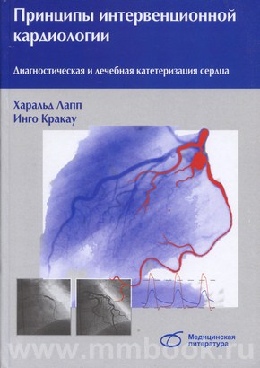 Принципы интервенционной кардиологии. Диагностическая и лечебная катетеризация сердца